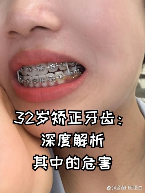 成人矫正牙齿的效果_成人矫正牙齿的利与弊知乎_成人牙齿矫正