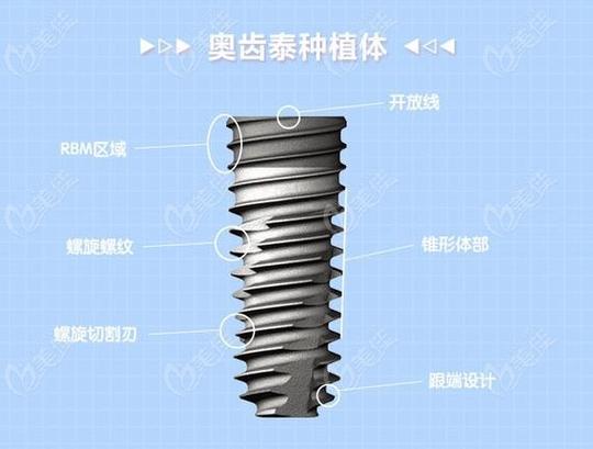 深圳常州百康特种植牙多少钱？本地人都在问的价格明细