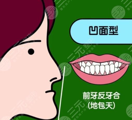深圳儿童地包天矫正多少钱?2026最新价格表来了