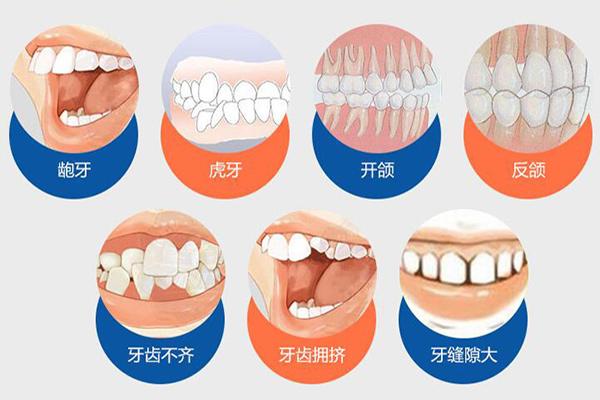 深圳合肥隐形牙齿矫正费用贵不贵？要多少钱？