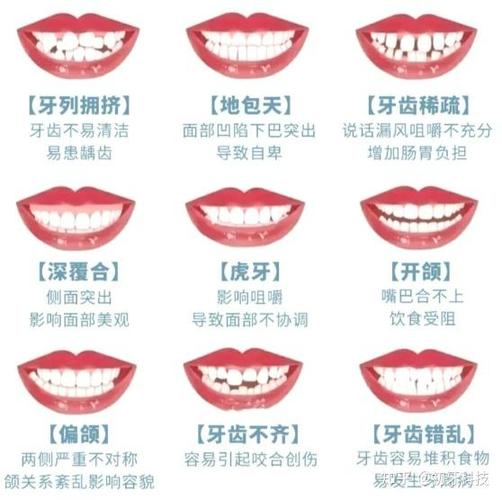 深圳南京牙齿矫正价格多少？2024年整牙费用全解析
