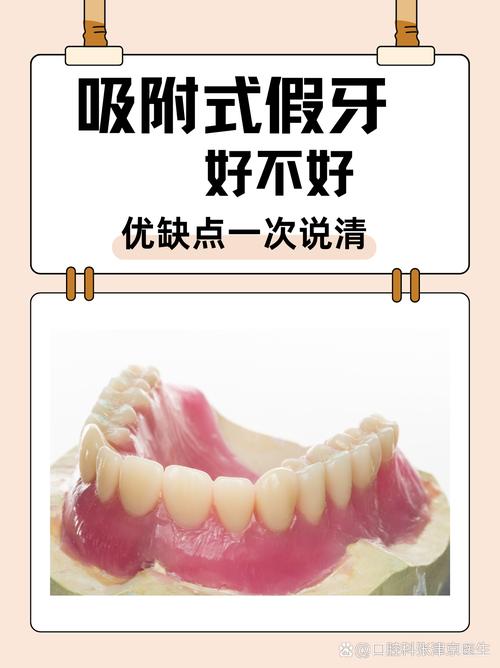 深圳缺牙不种牙？活动假牙固定桥吸附性义齿哪个好