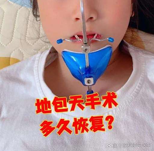 牙齿矫正颌垫_矫正牙齿正颌_牙齿矫正颌导板的作用