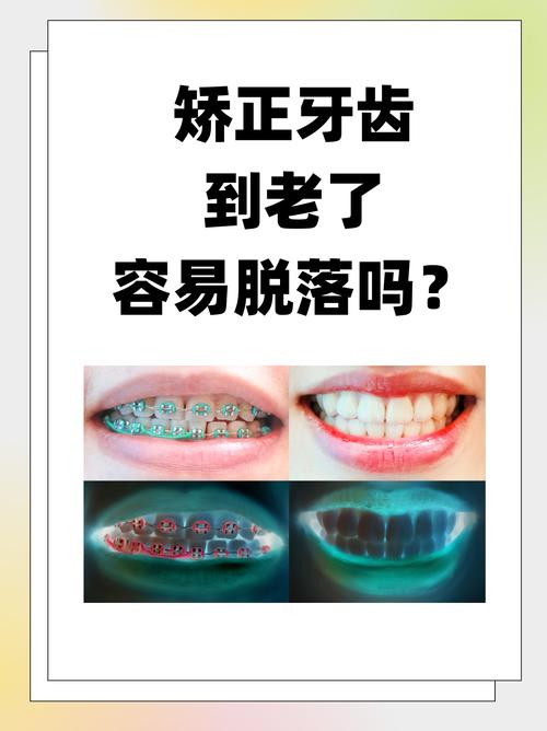牙齿矫正的最晚_39岁做牙齿矫正晚不晚_矫正牙齿晚上戴的是什么仪器