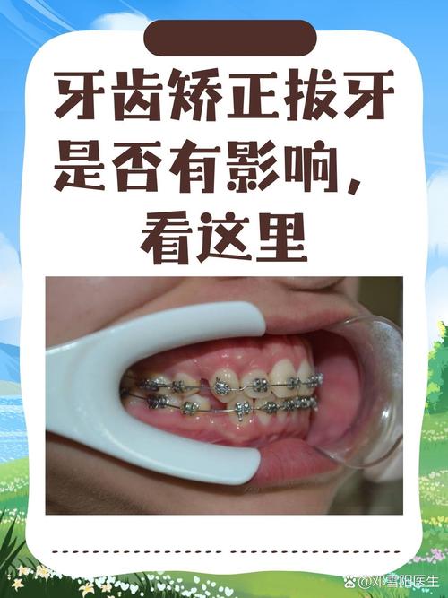 牙齿矫正医院推荐_牙齿矫正医院好还是牙医诊所好_哪个医院牙齿矫正