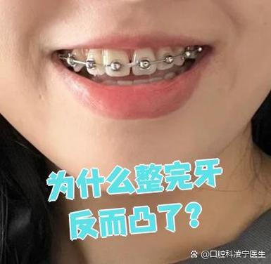 深圳牙齿不齐别担心 纠正牙齿的较佳年龄看这里