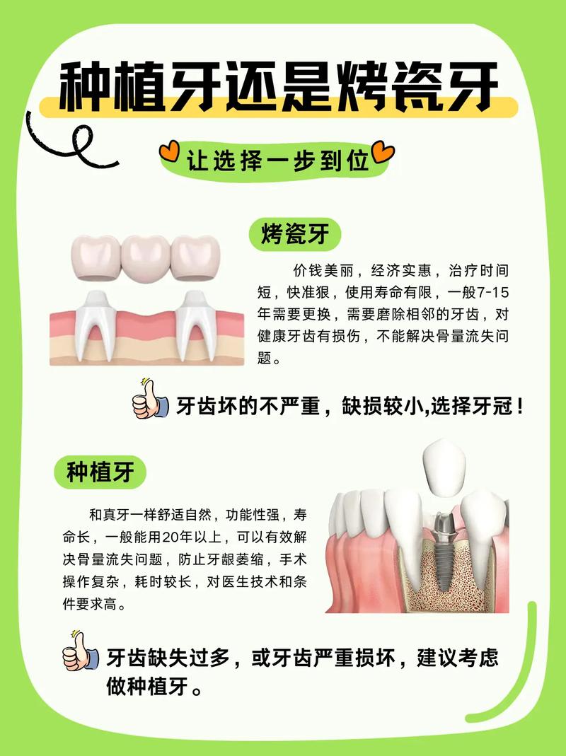 深圳烤瓷牙还是种植牙 牙医教你选对修复方式