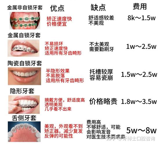 深圳福田青少年钢丝正畸费用_深圳福田青少年钢丝正畸费用_深圳福田青少年钢丝正畸费用