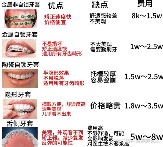深圳福田青少年做钢丝牙套大概要花多少钱?