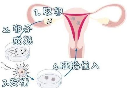 深圳第三代试管婴儿准备多少预算?这笔账你得算明白