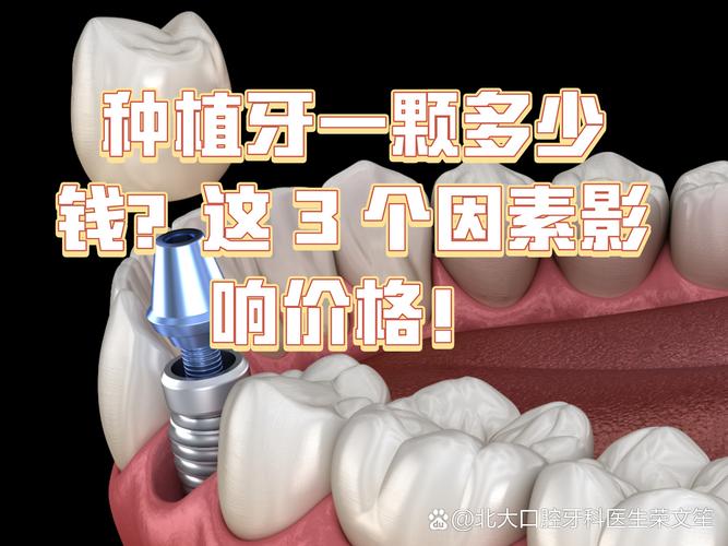 深圳镶一颗种牙要多少钱 影响种植牙费用的关键因素梳理