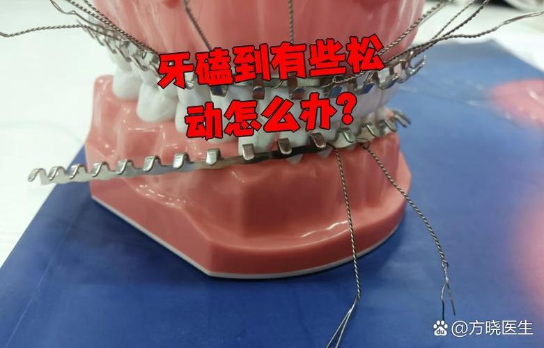深圳孩子牙齿磕碰松动了怎么办?多久能自己长好