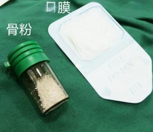 种牙骨粉多少钱一克正常_牙口种骨粉价格是多少_半口种牙骨粉价格