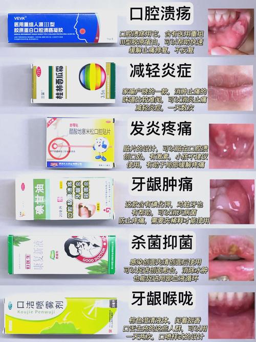 深圳小孩口腔溃疡吃什么好的快?收下这份家庭偏方与饮食指南,轻松缓解娃的疼痛