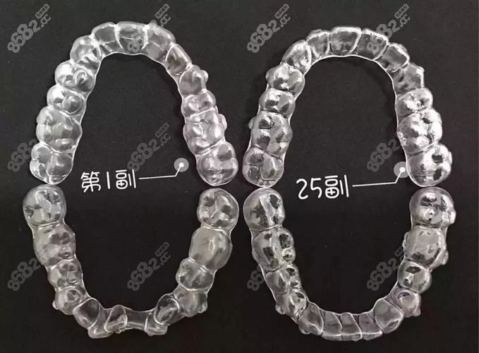 深圳隐适美矫正费用全公开 花多少钱心里有数