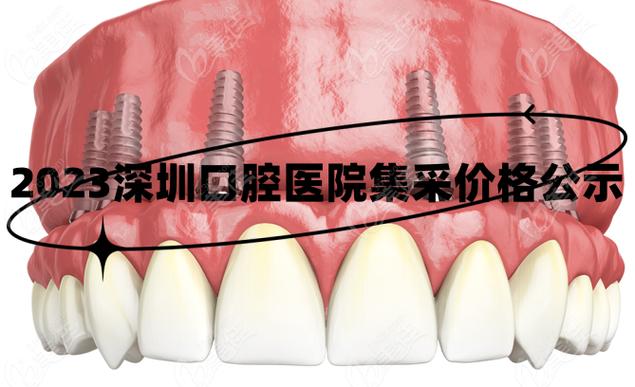深圳种牙集采落地,到底能省多少钱?