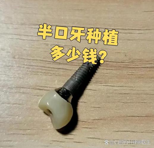 深圳宝安半口种牙多少钱 中老年价格详解