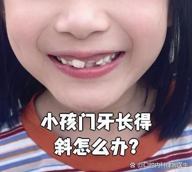 深圳孩子换牙门牙歪斜怎么办?专业干预指南与避坑建议
