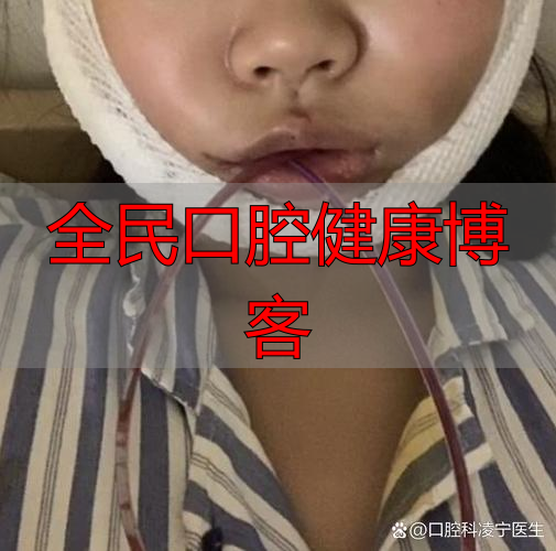 深圳口腔颌面部受伤啥特点?不只影响呼吸进食,感染风险也很高