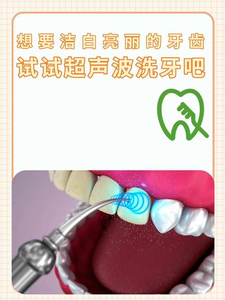 深圳自己用超声波洗牙安全吗?洗牙是医疗行为,别自己瞎搞