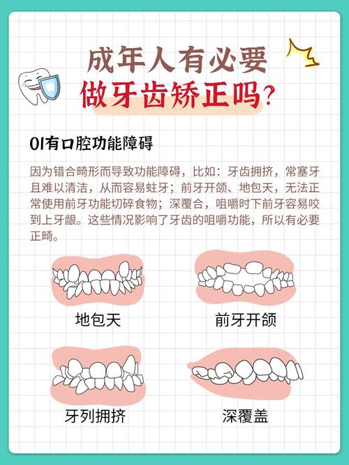 牙齿矫正适合什么牙齿情况_25岁还适不适合牙齿的矫正_牙齿矫正适用人群