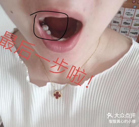 深圳宝安新安种植牙哪家医院好?真实体验告诉你