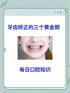 深圳16岁矫正牙齿真的晚吗?抓住黄金期的尾巴,效果一样好
