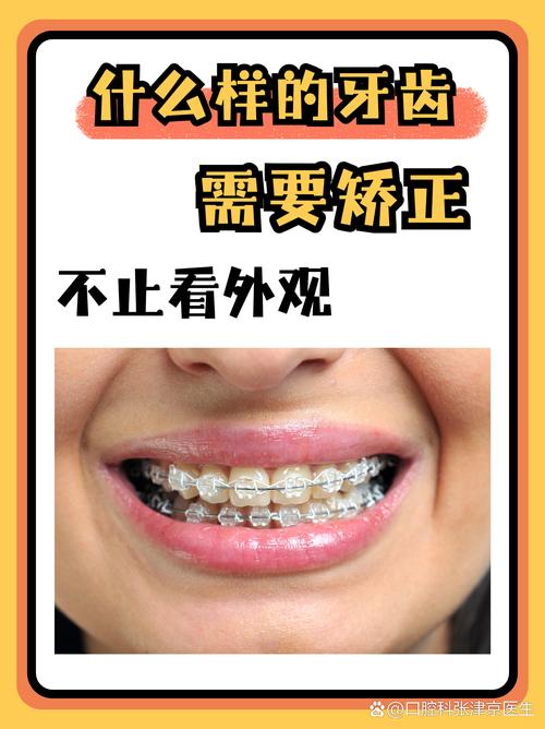 牙齿矫正可以改变脸型吗_25岁还可以矫正牙齿不_牙齿矫正可以只做上排牙吗