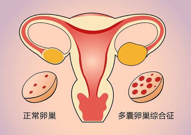 深圳HIV治疗后到底能不能生孩子？感染者生育指南