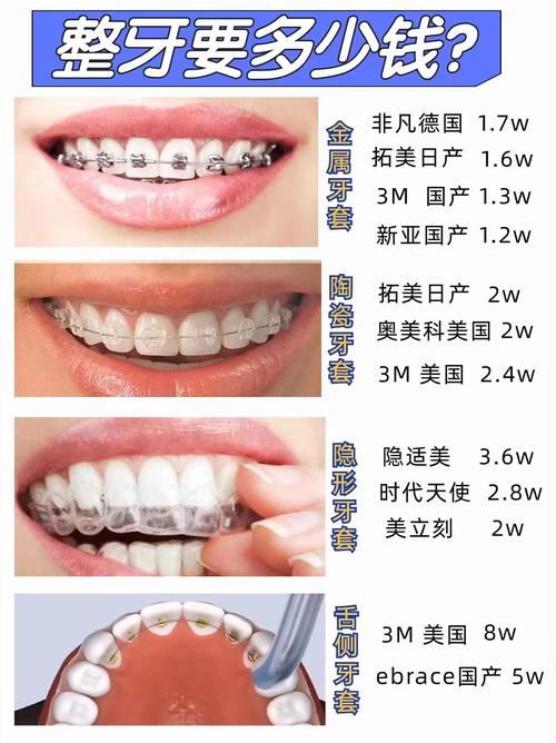 舌系带矫正术有什么风险吗_牙齿矫正舌系带手术_矫正牙齿舌系带多少钱
