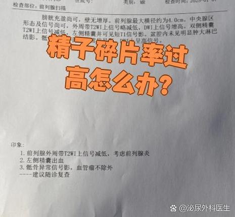 精子DNA碎片率_精子dna碎片检查费用_精子dna碎片检查上海医院