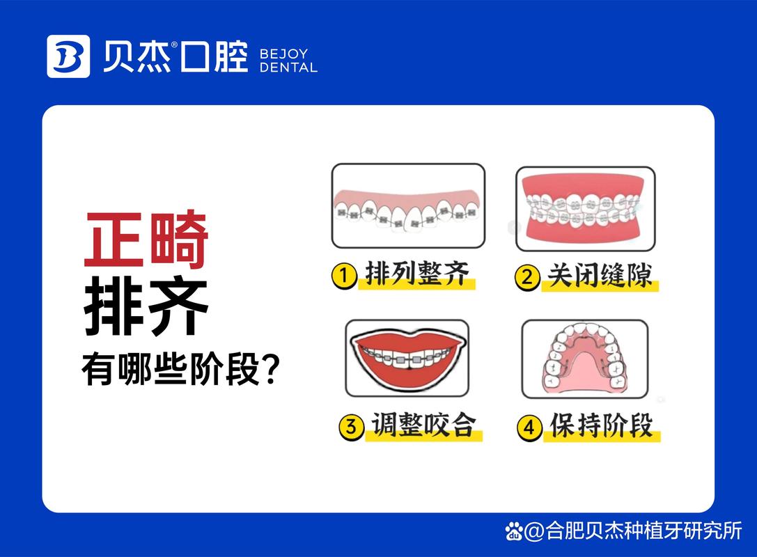 儿童医院正畸_儿童牙错位矫正医院推荐_矫正牙错位儿童医院推荐哪家