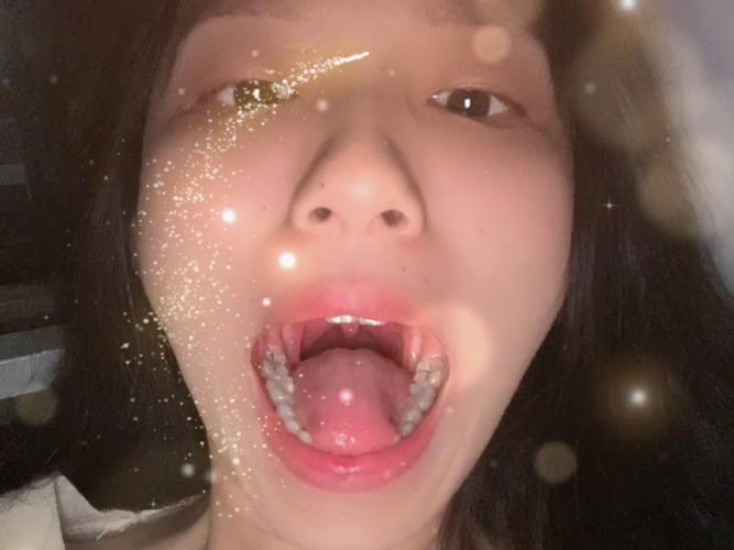 深圳口腔检查第一视角真的有用吗?