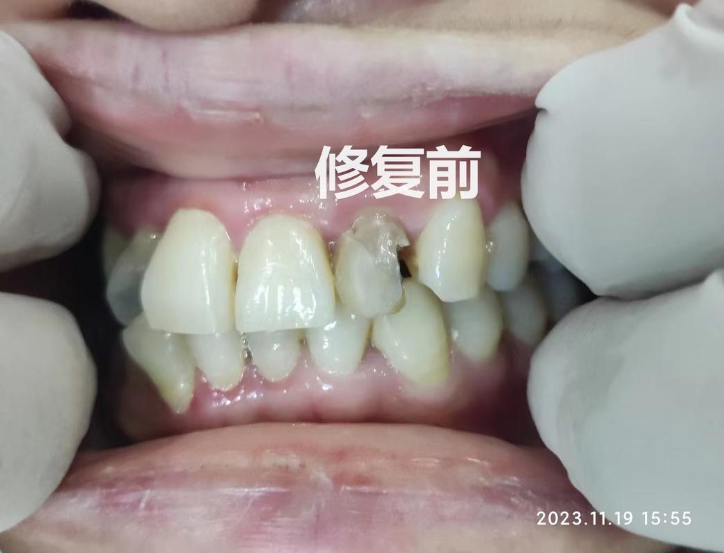 深圳口腔诊疗服务怎么挑不踩坑?看牙前你最好先把这几条搞明白