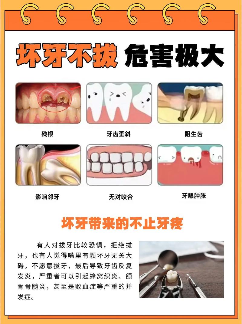 深圳大牙拔掉后不种植 小心这些后果