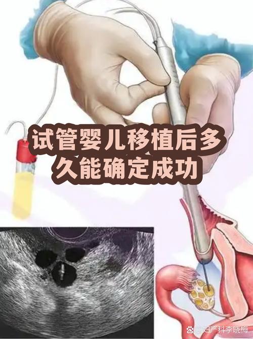 深圳一代试管婴儿能成功吗 看完心里有底