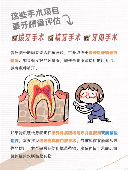 深圳骨质疏松能种牙吗 掌握这几点放心种