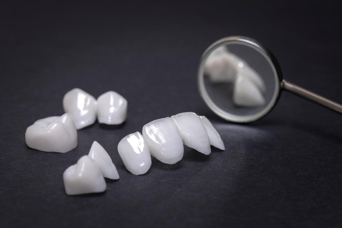 深圳牙齿矫正贴片价格揭秘：不同材质与方案费用详解