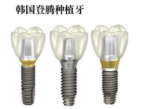 深圳株洲种牙哪家强？公立医院性价比之选