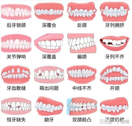 深圳儿童牙齿矫正一般价格多少?带娃整牙到底花几万