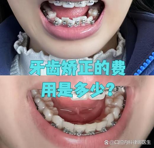 武汉儿童矫正牙齿哪里好_武汉儿童矫正牙齿多少钱_牙齿矫正武汉钱儿童可以用吗