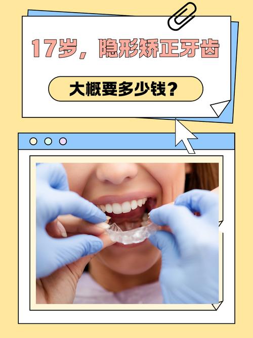 深圳德韩隐形矫正牙齿效果好吗 价格多少