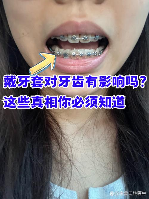 深圳成人矫正牙齿口腔值得做吗 这些真相医生不会主动说