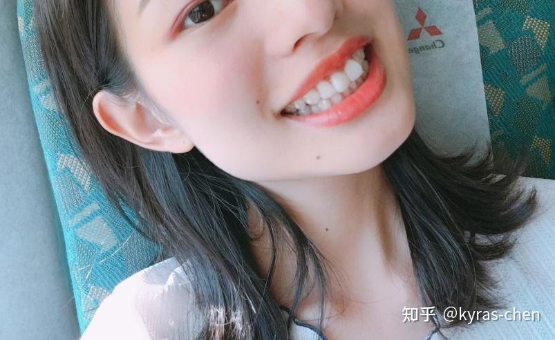 深圳成人门牙不齐矫正真的很简单吗