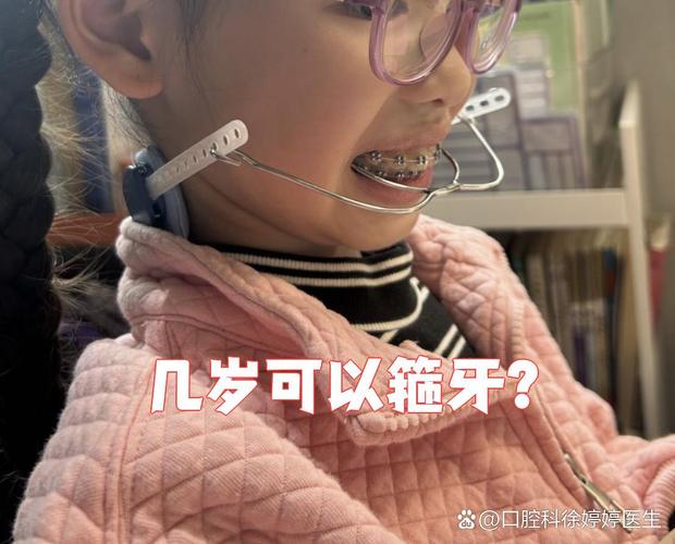 深圳11岁孩子牙齿矫正,到底合不合适?