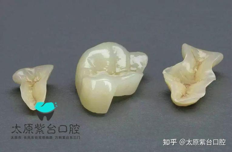 深圳口腔检查反馈单看不懂？3步教你秒读