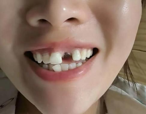 深圳看牙能网上问医生吗？口腔在线解答到底靠不靠谱