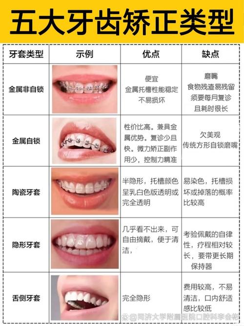深圳21岁矫正牙齿不晚!成人正畸时长与效果解析