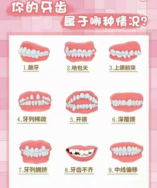 牙齿矫正可以改变脸型吗_21岁了牙齿可以矫正吗_牙齿矫正可以只矫正几颗吗