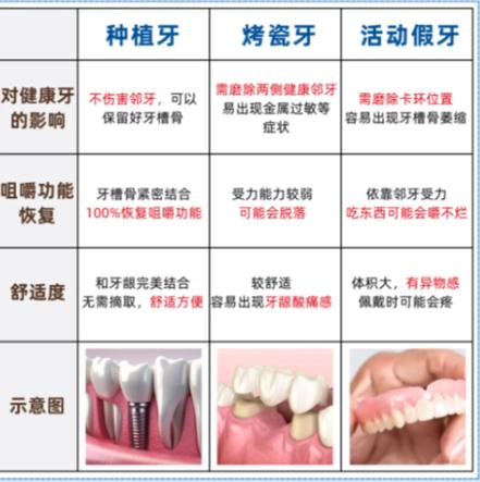 深圳赤峰种牙别乱选 公立三甲医院才靠谱